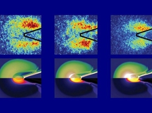 x-ray breakthrough